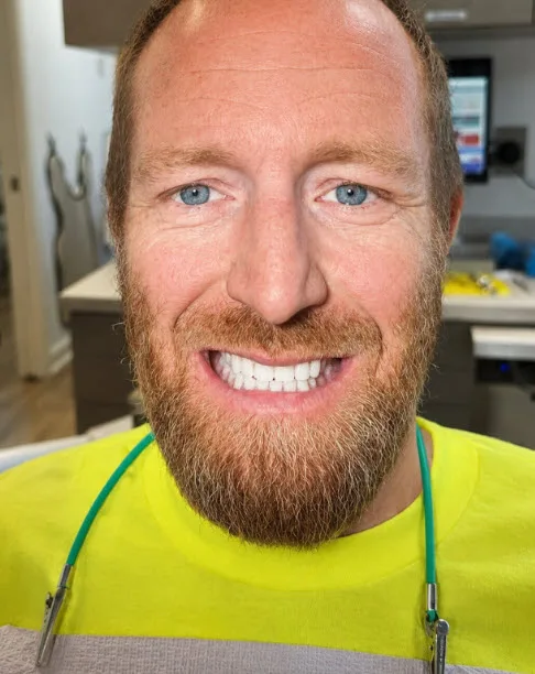 Case 3 Implant-Supported Dentures — after treatment
