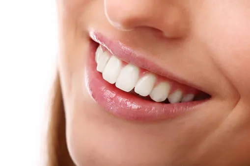 Close-up of a beautiful smile after a dental cleaning