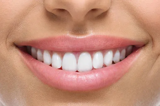 Perfect smile after porcelain crown treatment on front teeth